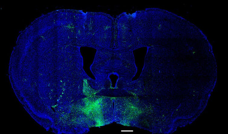 Imagem de microscopia de uma seção transversal do cérebro de um camundongo com a metade inferior do meio polvilhada de verde